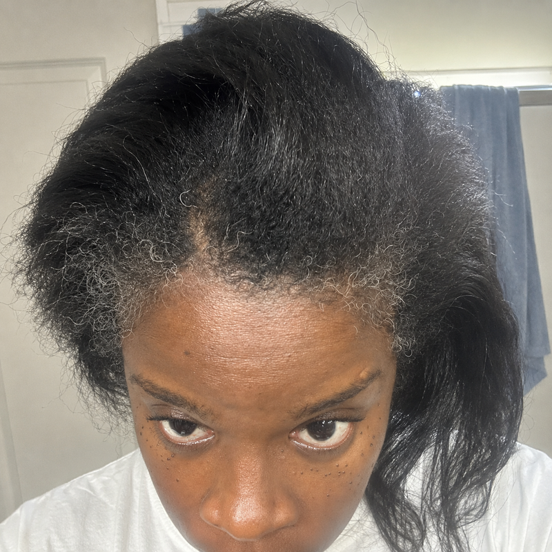 Before image